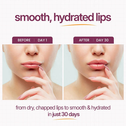 Calcium Multi Balm | LOVILDS™ Anti-aging, Sagging, Wrinkles